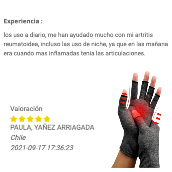 Testimonio 1 GUANTES de compresión KENKOTHERM